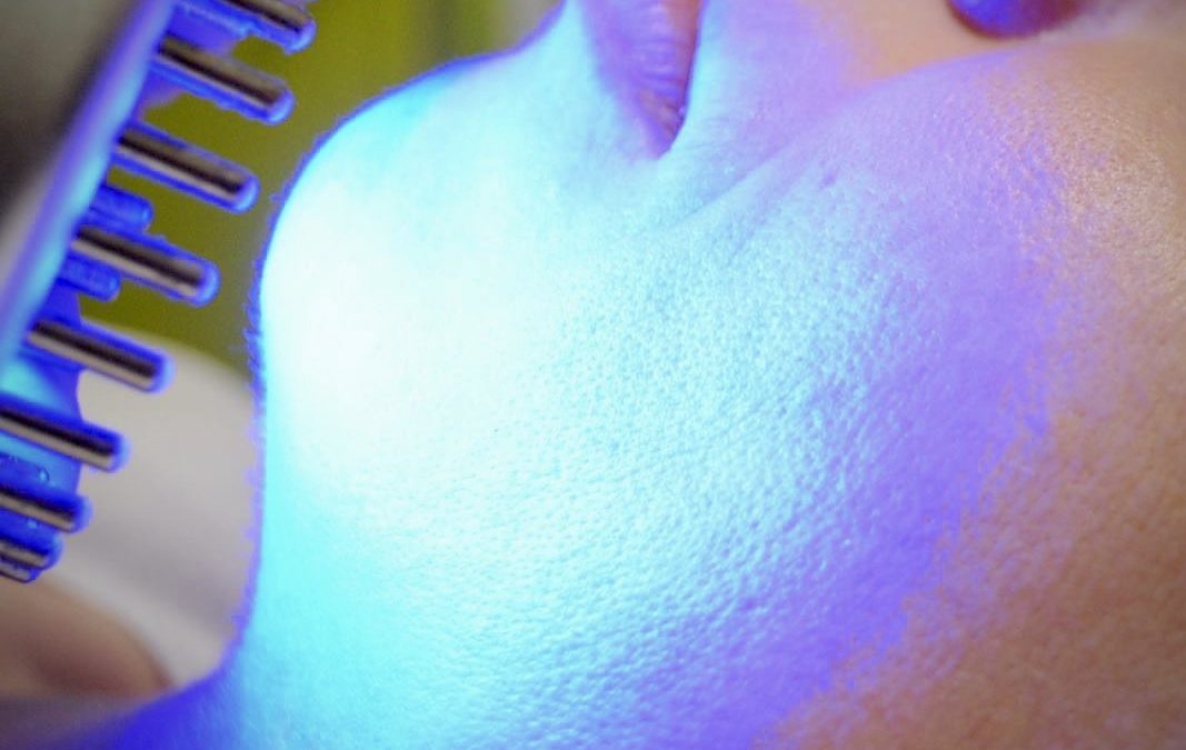 How LED light therapy can help acne-prone skin