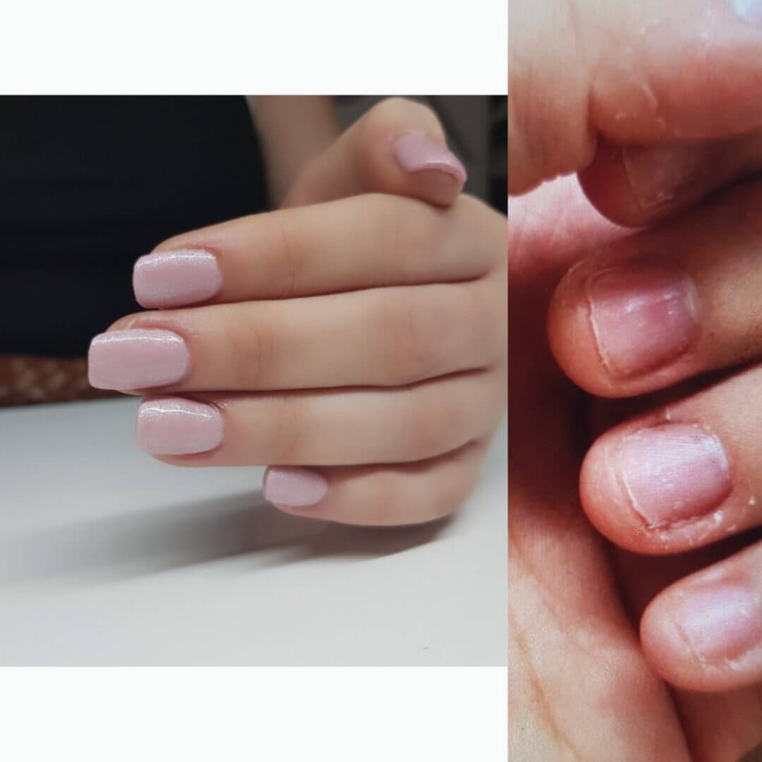 Can I get nail extensions if I bite my nails? Figaro London
