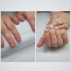 Nail extensions for a nail biter