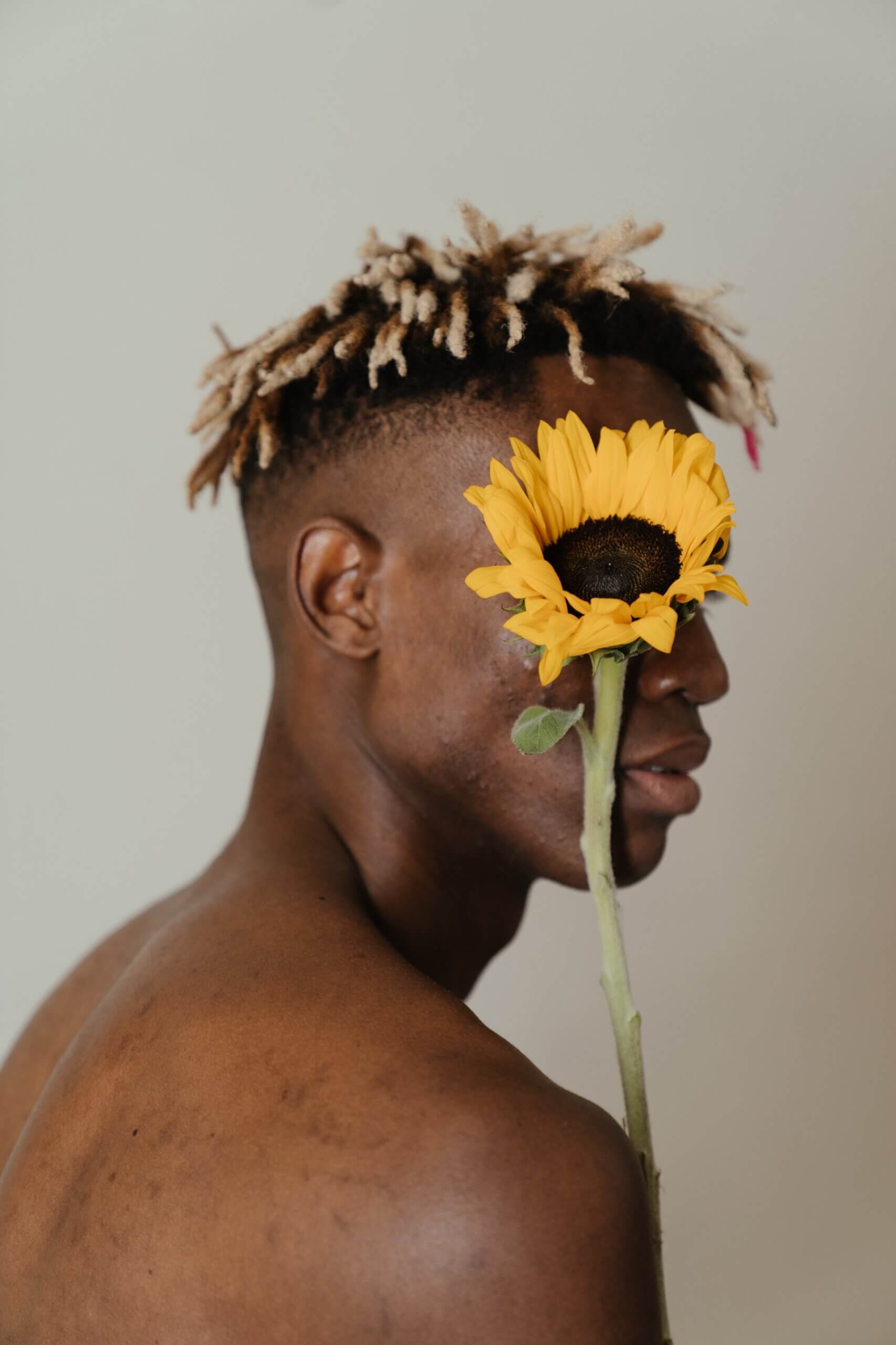 A man embracing acne with a sunflower